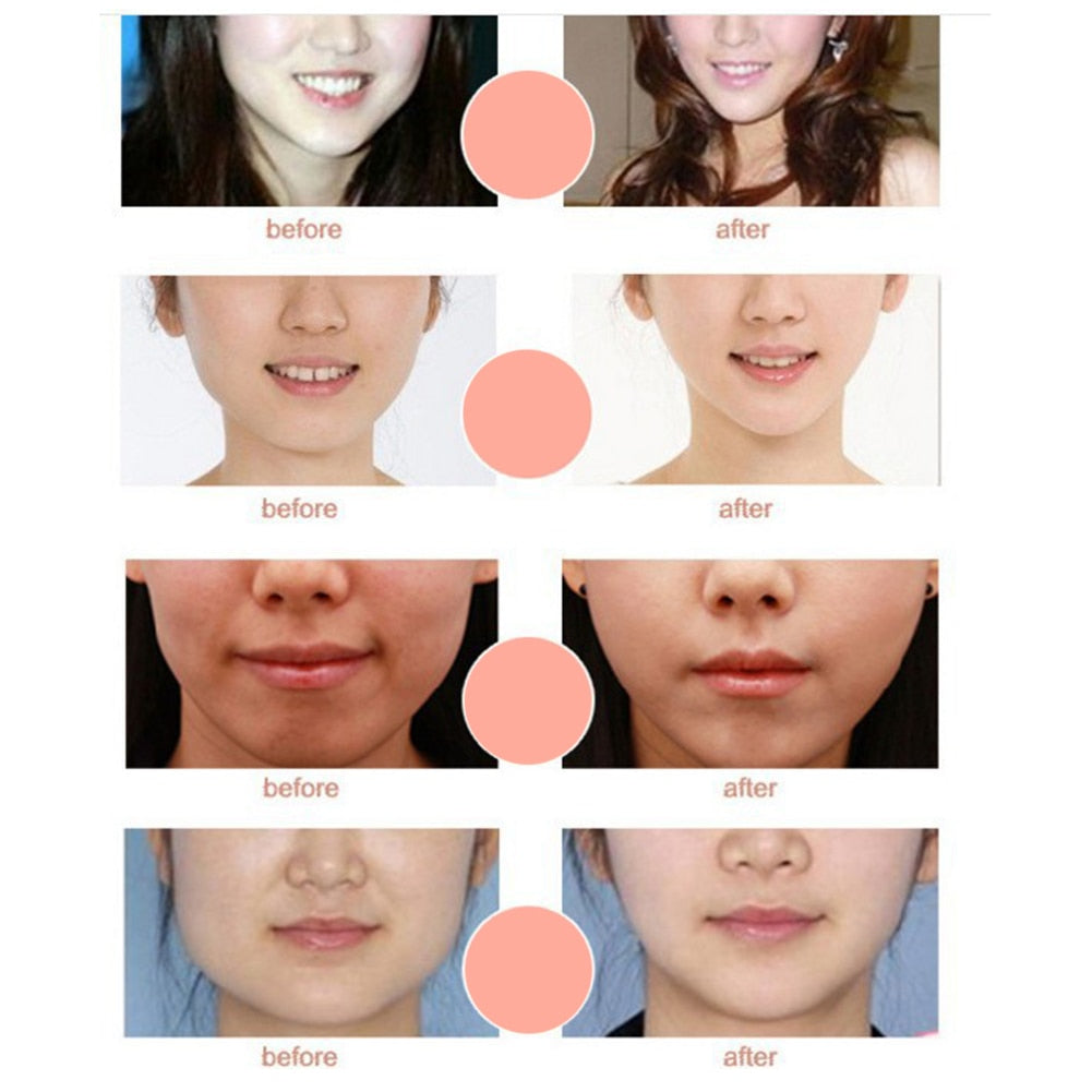Miracle V-Shaped Slimming Mask